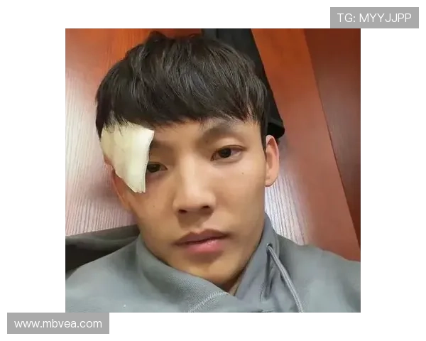 足球明星比赛中眉骨受伤紧急缝针现场直击球迷心痛不已 足球明星比赛中眉骨受伤紧急缝针现场直击球迷心痛不已